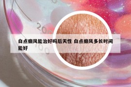 白点癫风能治好吗后天性 白点癫风多长时间能好