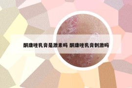 酮康唑乳膏是激素吗 酮康唑乳膏刺激吗