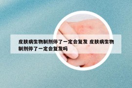 皮肤病生物制剂停了一定会复发 皮肤病生物制剂停了一定会复发吗