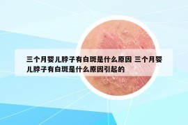 三个月婴儿脖子有白斑是什么原因 三个月婴儿脖子有白斑是什么原因引起的