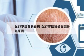 女27岁后背长白斑 女27岁后背长白斑什么原因