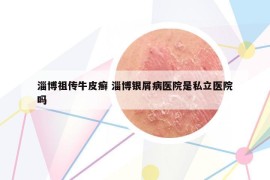淄博祖传牛皮癣 淄博银屑病医院是私立医院吗