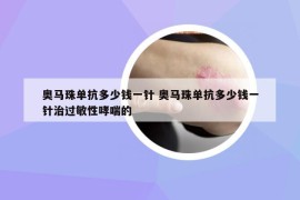 奥马珠单抗多少钱一针 奥马珠单抗多少钱一针治过敏性哮喘的