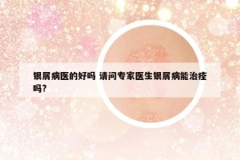 银屑病医的好吗 请问专家医生银屑病能治痊吗?