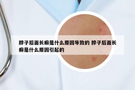 脖子后面长癣是什么原因导致的 脖子后面长癣是什么原因引起的