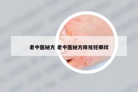 老中医秘方 老中医秘方除祛妊娠纹