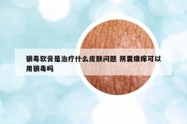 狼毒软膏是治疗什么皮肤问题 阴囊瘙痒可以用狼毒吗