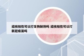 结核阳性可以打生物制剂吗 结核阳性可以打新冠疫苗吗