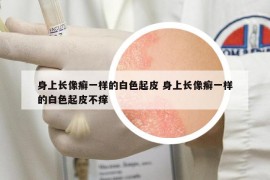 身上长像癣一样的白色起皮 身上长像癣一样的白色起皮不痒