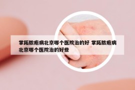 掌跖脓疱病北京哪个医院治的好 掌跖脓疱病北京哪个医院治的好些