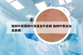 柏树叶和楮桃叶洗澡治牛皮癣 柏树叶煮水治皮肤病