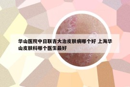 华山医院中日联吉大治皮肤病哪个好 上海华山皮肤科哪个医生最好