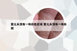 婴儿头顶有一块白色区域 婴儿头顶有一块白斑