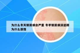 为什么冬天银屑病会严重 冬季银屑病消退期为什么很慢