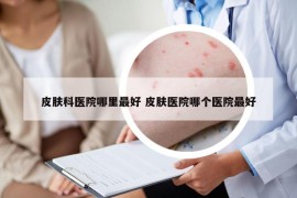 皮肤科医院哪里最好 皮肤医院哪个医院最好