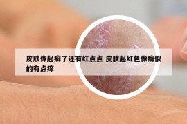 皮肤像起癣了还有红点点 皮肤起红色像癣似的有点痒