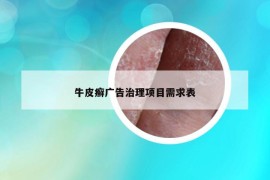 牛皮癣广告治理项目需求表