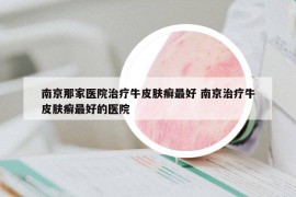 南京那家医院治疗牛皮肤癣最好 南京治疗牛皮肤癣最好的医院