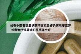 长春中医看银屑病医院哪家最好的医院哪家好 长春治疗银屑病的医院哪个好