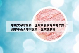 中山大学附属第一医院银屑病专家哪个好 广州市中山大学附属第一医院皮肤科