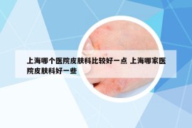 上海哪个医院皮肤科比较好一点 上海哪家医院皮肤科好一些