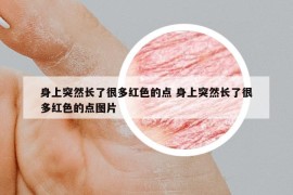 身上突然长了很多红色的点 身上突然长了很多红色的点图片