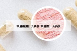 银屑癣用什么药膏 银屑擦什么药膏