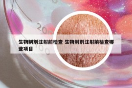 生物制剂注射前检查 生物制剂注射前检查哪些项目