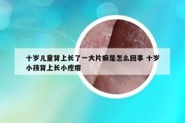 十岁儿童背上长了一大片癣是怎么回事 十岁小孩背上长小疙瘩