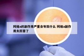 阿维a的副作用严重会导致什么 阿维a副作用太厉害了