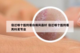 宿迁哪个医院看白癜风最好 宿迁哪个医院看男科更专业