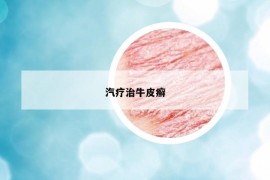 汽疗治牛皮癣