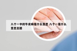 八个一中的牛皮癣是什么意思 八个一是什么意思主题