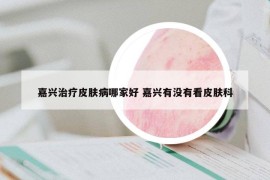 嘉兴治疗皮肤病哪家好 嘉兴有没有看皮肤科