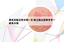 激光去胎记多少钱一次 脸上胎记去除手术一般多少钱