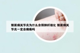 银屑病关节炎为什么会得肺纤维化 银屑病关节炎一定会瘫痪吗