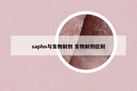 sapho与生物制剂 生物制剂区别