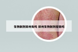 生物制剂郑州有吗 郑州生物制剂报销吗