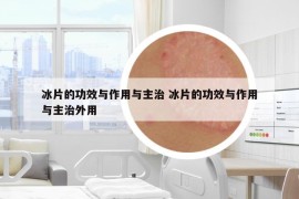 冰片的功效与作用与主治 冰片的功效与作用与主治外用