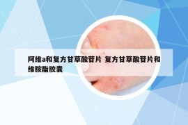 阿维a和复方甘草酸苷片 复方甘草酸苷片和维胺酯胶囊