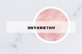 消除牛皮癣留下的印