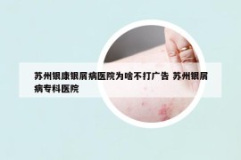 苏州银康银屑病医院为啥不打广告 苏州银屑病专科医院