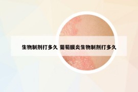 生物制剂打多久 葡萄膜炎生物制剂打多久