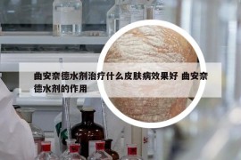 曲安奈德水剂治疗什么皮肤病效果好 曲安奈德水剂的作用