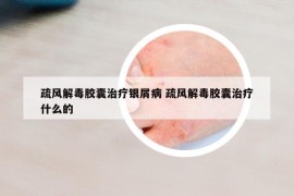 疏风解毒胶囊治疗银屑病 疏风解毒胶囊治疗什么的