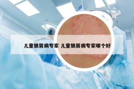 儿童银屑病专家 儿童银屑病专家哪个好