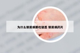 为什么银屑病要吃骁悉 银屑病药片