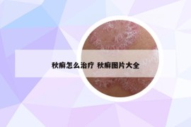 秋癣怎么治疗 秋癣图片大全