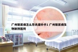 广州银屑病怎么荐夫康妙手1 广州银屑病生物制剂医院