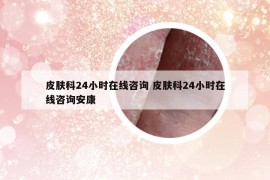 皮肤科24小时在线咨询 皮肤科24小时在线咨询安康